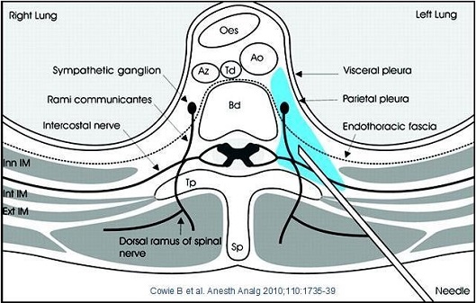 A cross-sectional view of the right lung and left lung which is located in the center of the image. The image is labeled with the names of the different parts of the lung including the sympathetic ganglion rami communicates intercostal nerve and endothoracic fascia. <br /><br />The left lung is located on the left side of the body with the right side facing towards the viewer. The right lung is on the top left corner and the left lung on the bottom right corner.<br /><br />There are several labels on the image including "Sympathetic ganglia" "Visceral pleura" and "Parietal pleura". These labels are likely used to indicate the location of the nerves in the neck and the location where the nerves are located. The diagram also shows the dorsal ramus of the spinal nerve which can be seen in the bottom left corner of the diagram.<br />- The image also includes a needle which may be used to connect the two parts together.
