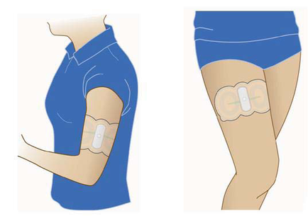 A side-by-side comparison of a person wearing a blue polo shirt and shorts. On the left side of the image there is a person's arm with a bandage wrapped around it. The bandage appears to be a type of adhesive bandage which is used to attach the bandage to the person's knee. The person is standing with their arm slightly bent at the elbow and their hand resting on their hip. The background is white and the image is divided into two parts. On the right side there are two illustrations of the same person one showing the same bandage on their knee and the other showing a similar bandage. Both illustrations are in a light blue color.