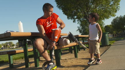 A young man and a young boy sitting on a park bench. The man is wearing a red t-shirt and shorts and is holding a prosthetic leg in his left hand. He is sitting on the bench with his right leg extended forward and his left leg bent at the knee. The boy is standing next to him looking at the man with a curious expression on his face. The background shows a park with trees and a blue sky. There is a white trash can on the right side of the image.
