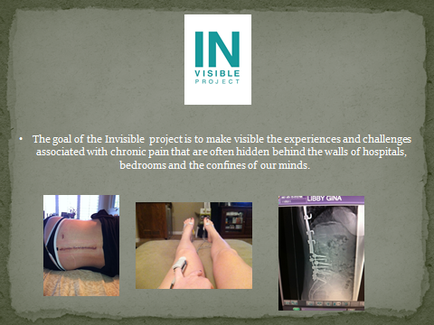 A slide from a presentation on the Invisible Project. It has a green background with the logo of the project in the top left corner. Below the logo there is text that reads "The goal of the Invisible project is to make visible the experiences and challenges associated with chronic pain that are often hidden behind the walls of hospitals bedrooms and the confines of our minds." On the left side of the slide there are three images. The first image on the top right shows a person lying on a bed with their head resting on a pillow. The second image in the middle shows a close-up of a person's legs with a bandage wrapped around their ankle. The third image is an X-ray image of a foot with a fracture. The image is accompanied by text that explains the project's mission and challenges.