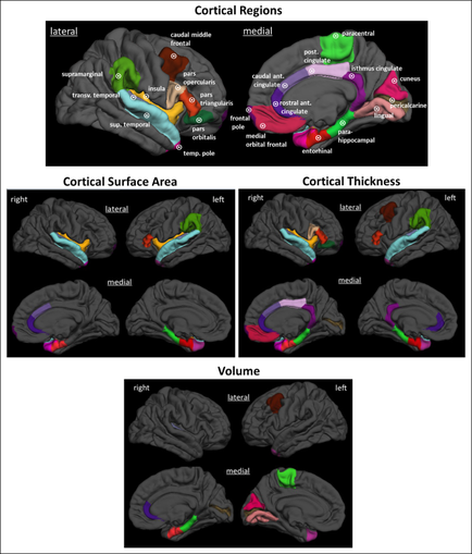 A collage of six different views of the human brain each showing a different area of the brain. The top left view shows the lateral and cortical regions of the head with the lateral area on the left side of the image and the cortical surface area in the center. The lateral area is labeled with the names of the different areas while the cortical areas are labeled with their respective names. In the top right view there is a diagram of the cerebral cortex which is a type of brain that shows the location of the cerebellum in the brain and the surrounding area. The cerebral cortex is colored in different shades of green blue red and purple representing the different regions. The medial area is colored with a red and green color scheme representing a different color scheme. The left side shows the left and right sides of the cortex with a green and red color scheme representing the medial and medial areas and a purple and green area representing a medial area. - The top middle view shows a diagram that shows that the cerebral area is divided into two sections one labeled "Cortical Surface Area" and the other labeled "Volume". The right side shows that there are two sections labeled "Lateral" and "Cortex Thickness". Overall the image shows the different types of cortical regions in the head and how they interact with each other.