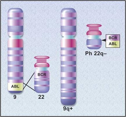 Three cylindrical objects which appear to be test tubes or vials. The objects are arranged in a horizontal line with the first object on the left being labeled "ABL" the second one being labeled as "BCR" and the third one being labelled as "Ph 22q-9q+". The objects have a pink and purple striped pattern on them. The background is a light blue color.