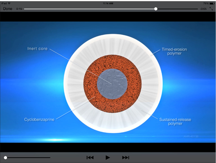 A 3D model of an eye with a blue background. The eye is divided into three sections. The top section is labeled "Inert core" the middle section is titled "Timed-erosion polymer" and the bottom section is labelled "Cyclobenzapine". In the center of the eye there is a circular structure with a red and orange color scheme. The outermost section has a white outer ring while the innermost part has a blue inner ring. The innermost ring has a gray inner ring which appears to be the inner core of the retina. On the right side of the image there are three labels labeled "Sustained-release polymer" and "Sustainable-release polymers". These labels are likely used to indicate the different types of polymer used in the eye. The labels also mention that the image is from a video or presentation.