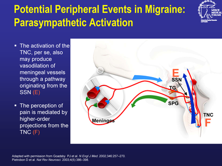 A diagram that shows the potential peripheral events in migraine: Parasympathetic Activation. It shows the activation of the TNC per se also may produce vasodilation of meningeal vessels through a pathway originating from the SSN (SSN) and the perception of pain is mediated by higher-order projections from the Tnc (F). The diagram is divided into two sections. On the left side there is a title that reads "Potential Peripheral Events in Migraine: parasympathetic Activate" and on the right side it explains the concept of the activation. In the center of the image there are two red and green arrows pointing towards the TNG (TNG) and sing (sing) vessels which are connected by red and blue lines. These arrows represent the connections between the two vessels. The red arrows indicate the flow of blood from the sing vessel to the SNN vessel while the blue arrows represent sing vessels. There is also a label on the bottom right corner that says "Adapted with permission from goosy P.J. and N.J."
