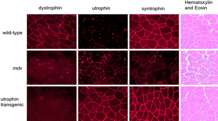 A collage of nine square tiles arranged in a grid-like pattern. Each tile has a different color background and a title at the top that reads "dystrophic" "strophic" and "syntrophin". The first tile on the top left shows a close-up of a wild-type of a plant stem with a dark red color. The stem appears to be made up of small irregularly shaped cells. The cells are arranged in two rows and three columns with the top row showing a darker red color and the bottom row showing the same red color as the rest of the tiles. In the top right corner there is a text box with the title "Hematoxylin and Eosin". The text box is labeled "wild-type" and the text box reads "mdx". Below the title there are nine smaller tiles in total each with a different pattern. The first tile shows a closer view of the stem with a darker pink color and a lighter pink color while the second tile shows the same pattern as the first tile. The third tile shows an image of the same stem but with a more intricate pattern.
