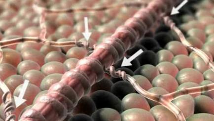 A close-up of a group of small round metallic spheres. The spheres are arranged in a radial pattern with the largest sphere in the center and the smaller ones on either side. The background is blurred but it appears to be made up of more spheres of different sizes and colors. There are two arrows pointing towards the top and bottom of the image one on the left side indicating the direction of the spheres. On the right side there is a larger more complex structure which is a spiral-like structure with multiple layers of metal wires or cables. The wires are connected to each other by thin curved lines. The metal wires appear to be connected to the larger spheres creating a complex and intricate pattern. The image is likely a 3D rendering giving it a realistic and detailed appearance.