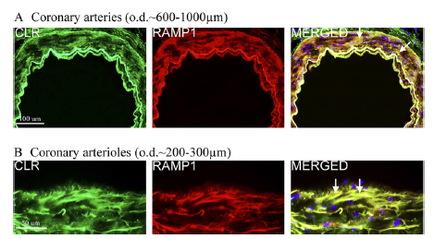 A collage of four images that show the different types of coronary arteries. The first image on the top left shows a close-up view of a coronary artery (clr) with a red and green color scheme. The artery appears to be elongated and has a curved shape. The red color is the dominant color in the image while the green color is a darker shade. In the top right image there is a closer view of the artery with a green and purple color scheme indicating that it is a normal artery. The image also shows a merged artery with red and yellow colors representing the blood vessels. The blood vessels are arranged in a circular pattern with the red blood vessels in the center and the yellow and purple blood vessels on either side. The merged arteries appear to be stained with a fluorescent dye which is a type of dye that helps to differentiate between the two types of arteries.