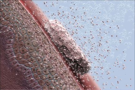 A close-up of a microscopic view of a human skin. The skin appears to be a reddish-brown color with a pattern of small irregularly shaped cells. The cells are arranged in a hexagonal pattern with some overlapping each other. In the center of the image there is a small white substance which is likely a type of bacteria or fungus. The substance is covered in small round white particles which are scattered across the skin. On the right side of the background there are a few smaller white bubbles that appear to be floating in the air. The image is taken from a top-down perspective looking down on the skin and the bacteria.