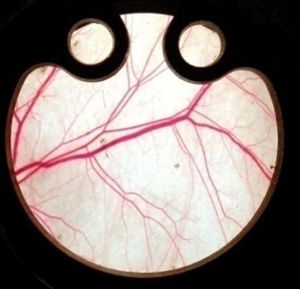 A close-up of a circular object with a black background. The object appears to be a microscope slide as there are two circular holes on either side of the image. In the center of the slide there is a white surface with a pink line running through it. The line is made up of thin thin lines that appear to be veins or arteries. The lines are arranged in a radial pattern creating a sense of depth and dimension. The image is taken from a top-down perspective looking down on the object.