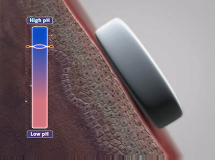 A close-up of a cross-section of a human skin. The skin appears to be a reddish-brown color with a textured surface. On the left side of the image there is a blue bar with the words "High pH" and "Low pH" written on it. Next to the blue bar there are two orange lines one representing high pH and the other representing low pH. On the right side of this image on the bottom right corner is a black rectangular object which is likely a magnet or magnet. The magnet is placed on top of the skin and it is slightly tilted to the left. The background is blurred so the focus is on the magnet and the surface it is resting on.