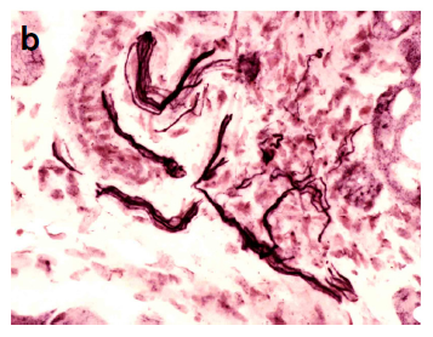The image appears to be a microscopic view of a tissue sample which is a type of tissue stained with a pinkish-purple color. The tissue appears to have a rough textured surface with small irregularly shaped cells scattered throughout. The cells are arranged in a radial pattern with some areas appearing darker and others appearing lighter. In the center of the image there is a large elongated structure that looks like a snake or a snake-like creature. The structure is made up of multiple lines and curves creating a sense of movement and energy. The image is labeled with the letter "b" in the top left corner indicating that it is a magnification magnification.