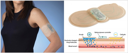 A side-by-side comparison of two images. On the left side there is a woman wearing a black tank top and a bandage on her arm. The bandage is attached to a beige-colored device which appears to be a blood vessel. The device is a battery-powered controller which is used to control the flow of blood through the blood vessels. On the right side of the image there are two images side by side. The first image shows the device in action with the bandage covering the woman's arm and the device attached to it. It is a small rectangular device with a clear plastic cover on top. The cover has a label that reads "Anode" and "Batteries/power controller" on it. The label also mentions that the device is powered by a battery and has a cathode which helps to regulate the blood flow. The image also shows a diagram of the blood vessel which shows the different types of blood vessels and how they interact with each other.
