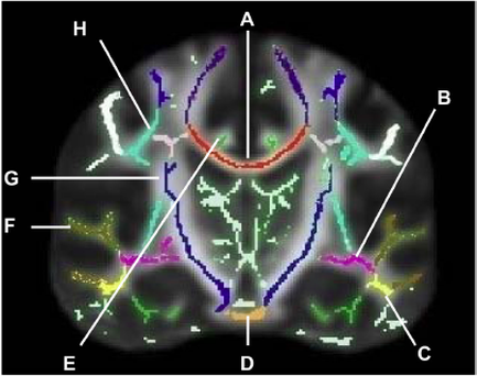 A cross-sectional view of the brain which is a representation of the human brain. The brain is shown in a black and white color scheme with the central part of the image being the brain in the center. The image is divided into four sections each representing a different part of a brain. The top section is labeled "H" "A" "B" "C" "D" "E" "F" "G" "H" and "E". The top section has a red line that runs through the center representing the brainstorm. The red line is connected to the brain by a series of curved lines which are arranged in a way that creates a sense of movement and energy. The lines are colored in different shades of blue green purple and yellow representing different types of neurons or structures. The green line represents the neurons while the purple line represents neurons and the yellow line represents structures which appear to be neurons or other structures that are connected to each other. There are also several lines connecting the different parts of the body such as the brain stem the cerebellum and the cerebrospinal cord. These lines are labeled with letters A B C and D indicating the direction of the movement. The letters A and B are labeled as "A" and B while "C" are labelled as "D" and C." Overall the image appears to be a brain scan showing the different types and structures that make up the brain and how they interact with each other in the brain.