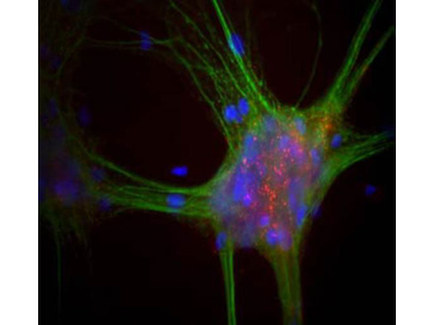 A close-up of a neuron which appears to be a type of nerve cell. The neuron is in the center of the image and is surrounded by green and blue neurons. The neurons are densely packed together with some of them overlapping each other. The green neurons are elongated and have a pointed tip while the blue neurons are smaller and more densely packed. The neurons are colored in shades of green blue and purple with the green neurons being the dominant color. The blue neurons appear to be clustered together in a circular pattern while purple neurons are scattered throughout the image. The background is black which makes the colors of the neurons stand out even more. The image appears to have been taken at night as there are no other objects or lights visible in the background.