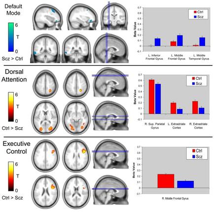 This is a data visualization consisting of 18 heatmaps of the brain & 3 interpretative bar charts. The heatmaps compare Scz and Ctrl for Default Mode Dorsal Attention and Executive Control. The bar charts compare Ctrl (in red) and Scz (in blue) for different regions of the brain (ex : left inferior frontal gyrus) each measuring Beta Value on the y-axis (on a scale from -0.1 to 0.7). 