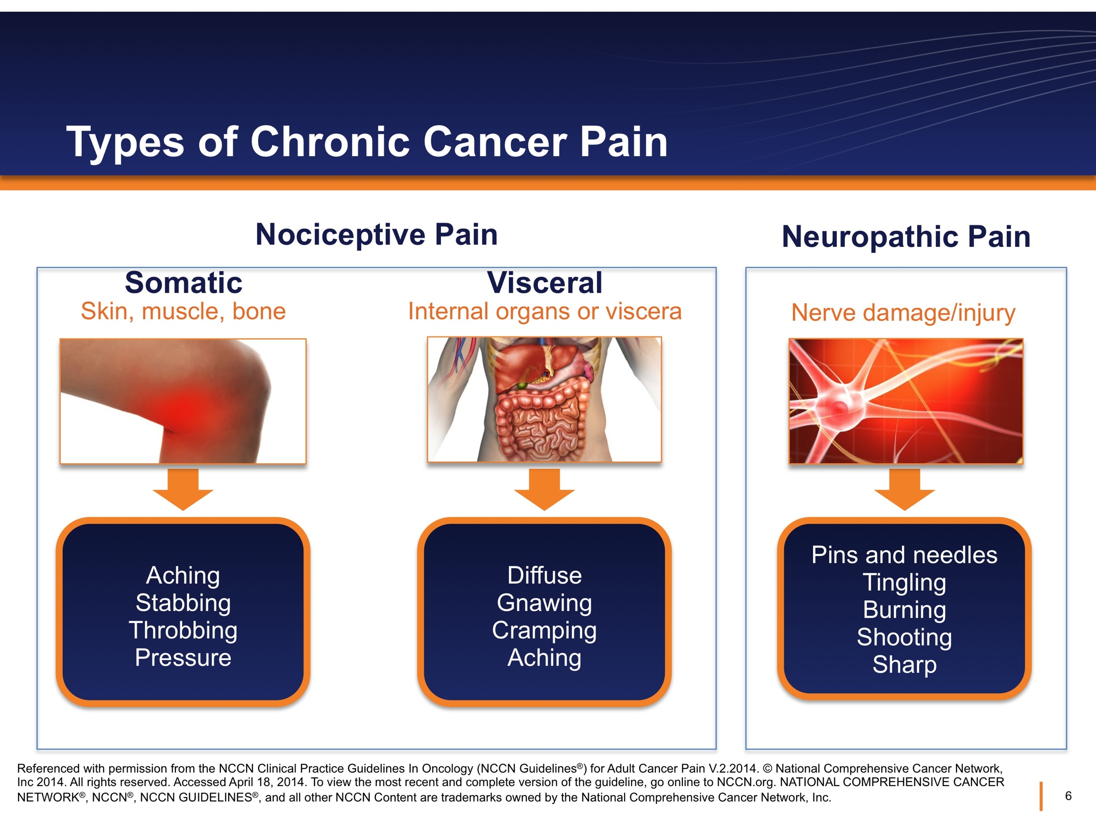 A slide from a presentation that features a diagram titled "Types of chronic cancer pain". It is divided into three sections.<br /><br />The first section is labeled "Somatic: skin muscle bone". It shows a picture of a knee with a red glow and has the text "aching stabbing throbbing pressure". The second section is labeled "Visceral: internal organs or viscera". It shows a cross-section of the human body featuring internal organs and has the text "diffuse gnawing cramping aching". The first two sections have a box around them labeled "Nociceptive pain". <br /><br />The third section is labeled "Nerve damage/injury". It shows a diagram of a nerve cell and has the text "Pins and needles tingling burning shooting sharp". The third section has a box around it labeled "Neuropathic pain". <br /><br />There are references at the bottom of the slide. The slide appears to be page 6 of the presentation.