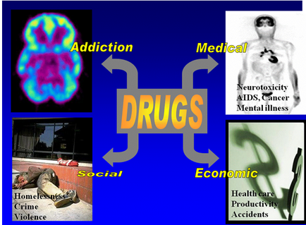 A collage of four different elements that represent different aspects of drugs. The first element on the top left is a brain scan of the brain representing addiction. The brain scan is colored in pink blue and green representing the different levels of addiction in the brain. The image is divided into four sections. On the top right corner there is a black and white illustration of a person's body with the words "Medical" and "Neurotoxicity AIDS Cancer Mental Illness" written above it. The illustration is accompanied by text that reads "Drugs" in orange and yellow letters. The text below the illustration reads "Social" "Economic" "Health care productivity accidents" and "Homelessness Crime Violence". In the center of the image there are four arrows pointing in different directions representing different types of drugs and their effects on the environment. The arrows are labeled with the word "Drug" in yellow letters indicating that the image is related to the concept of drugs social economic and health care.