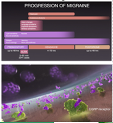 A screenshot of a webpage titled "Progression of Migraine". The webpage has a black background with a purple header and footer. At the top of the page there is a title in white text that reads "PROGRESSION OF MIGRAINE". Below the title there are several options for the user to choose from. The main content of the webpage is divided into two sections. The top section has a list of different sections each with a title and a brief description of the topic. The first section has an image of a group of purple spheres representing the progression of migraine. The second section has two images of purple flowers representing cancer cells. The flowers are arranged in a grid-like pattern with some overlapping each other. The background is a gradient of purple and green with a few white dots scattered throughout. The overall color scheme of the image is predominantly purple green and orange.