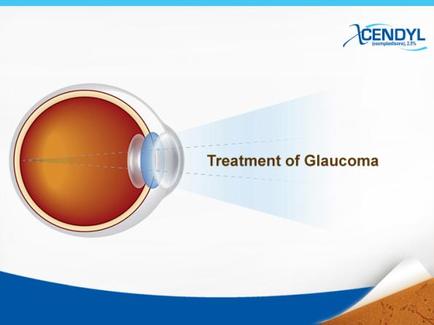 An illustration of a human eye with the text "Treatment of Glaucoma" above it. The eye is shown in a circular shape with a blue cap on top. The background is white and there is a blue wave-like pattern on the right side of the image. The text is written in black and is in a modern sans-serif font. The image is likely related to the treatment of glaucoma which is a type of eye disease that causes inflammation and pain in the eyes.