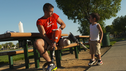 A young man sitting on a bench with a prosthetic leg. He is wearing a red t-shirt and shorts and is holding the leg with both hands. The man is looking down at the ground and appears to be explaining something to the young boy. The boy is standing next to the bench and is looking at the man with a curious expression. The background shows a park with trees and a blue sky. There is a white trash can on the right side of the image.