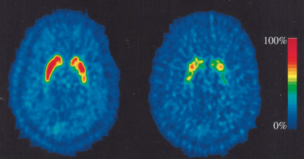Two circular structures one in blue and the other in red and yellow with a black background. The structures appear to be made up of a series of concentric circles with the blue sphere on the left and the red sphere in the center. The red sphere is slightly larger than the yellow sphere and it appears to be slightly smaller than the green sphere. On the right side of the image there is a bar graph that shows the percentage of people who have been diagnosed with cancer. The bars are colored in red yellow and green indicating that the majority of the people in the image are diagnosed with the cancer. There is also a red bar on the top right corner which shows that the percentage is 100%. The image appears to have been taken from a top-down perspective as there are no other objects or structures visible in the background.