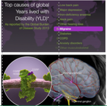 A collage of two images. The top image is titled "Top causes of global years lived with Disability (YLD)". It is a report by the Global Burden of Disease Study 2013. The top image shows a map of the world with the title of the report written in purple text. Below the title there is a list of the top causes of the disease including "Low back pain" "Major depression" "Neck pain" and "Other hearing loss". In the bottom image there are two images - one is a close-up of the brain and the other is a 3D model of the human brain. The brain is shown in blue and red colors with the red lines representing the blood vessels and the green lines representing blood vessels. The blood vessels are labeled with the names of the different types of diseases such as diabetes anxiety disorders and other neurological disorders. The image also includes a legend that explains the meaning of each cause.