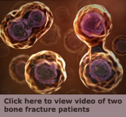 A group of three bone fracture patients. The background is a dark brown color and the patients are shown in a 3D rendering. The patients are arranged in a triangular formation with the largest one in the center and two smaller ones on either side. The largest one is a pinkish-purple color while the smaller one is an orangeism-brown color. The image appears to be a digital illustration as there is text at the bottom that reads "Click here to view video of two bone fractures patients."