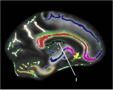 A 3D model of a human brain which appears to be a representation of the human brain. The brain is shown in a circular shape with the top half of the brain facing towards the left side of the image. The top half is black while the bottom half is white. The brain is colored in different shades of blue green yellow pink and purple with some areas of red orange and yellow. The colors are arranged in a way that creates a wave-like pattern around the brain creating a sense of movement and energy. There are also several lines and dots scattered throughout the brain in different colors representing different parts of the body. The lines are curved and appear to be connected to each other suggesting that the brain is moving or moving in different directions. The image also has a white arrow pointing to the right side indicating that the image is meant to represent the direction of the movement.