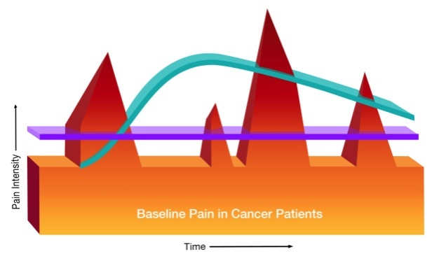 A graph that shows the relationship between time and pain intensity for cancer patients. The graph shows a section at the bottom labelled "Baseline pain in cancer patients". There are four large red spikes indicating increases in pain. There is a horizonal purple line as well as a curved blue line. 