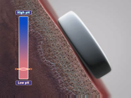 A close-up of a cross-section of a human skin. The skin appears to be a reddish-brown color with a textured surface. On the left side of the image there is a blue bar with the words "High pH" and "Low pH" written on it. Next to the blue bar there are two orange lines one representing the high pH and the other representing the low pH. On the right side of this image on the bottom right corner is a black rectangular object which is likely a magnet or magnet. The magnet is placed on top of the skin and it is slightly tilted to the left. The background is blurred so the focus is on the magnet and the surface it is resting on.