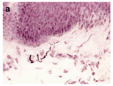 A microscopic view of a tissue sample which appears to be a cross-section of a human body. The tissue is predominantly purple in color with some areas appearing darker and more densely packed. The surface of the tissue is covered in small irregularly shaped cells which are scattered throughout the image. In the center of the image there is a thin black line that runs diagonally across the tissue. The line appears to have a small amount of blood or fluid flowing through it. The image is labeled with the letter "a" at the top indicating that it is a magnification magnification.