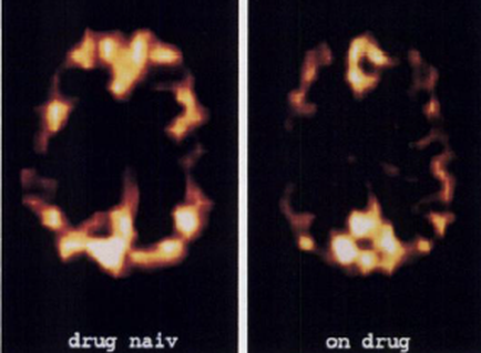 A collage of two photographs side by side. On the left side there is a black background with a large orange and yellow explosion in the center. The explosion appears to be made up of a series of curved lines and shapes creating a chaotic and chaotic pattern. The text "drug nail" and "on drug" are written in white text above and below the explosion. The image is taken from a top-down perspective looking down on the explosion and the text below it.