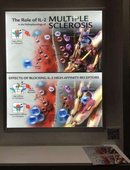 A presentation slide titled "The Role of IL-2 Multiple Sclerosis in the Pathophysiology of Sclerosis". The slide is divided into two sections. The top section is titled "Effects of Blocking IL2 High-Affinity Receptors" and has an illustration of a blood vessel with multiple sclerosis cells. The cells are shown in different colors and sizes representing different types of sclerosis. The bottom section of the slide has a title that explains the effects of blocking IL2 high-affinity receptors. The title is written in bold black font and is accompanied by a subtitle in smaller white font. The slide also has a QR code on the right side which is likely used to access information about the slide.