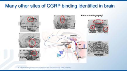 A diagram that shows the different sites of carp binding in the brain. It is divided into six sections each representing a different site. The first section on the top left shows a super-collicularis (super-colloidal) with a red circle in the center. The second section shows a rat autoradiographs (Rat Autoradiograph) with the text "Hippocampus amyloid" and "Cerebellum" written on it. The third section shows an illustration of the brain with a blue arrow pointing to the left side of the image. The fourth section shows the brainstorm with a white arrow pointing towards the right side. The fifth section shows two red circles one labeled "PAG" and the other labeled "CEREMBULUM". The sixth section shows three red circles with text that reads "Adapted with permission from Sexton et al. Neurosciences 1986-1995". Overall the image is an illustration that shows how the corps binding in a brain can be used to identify different sites.