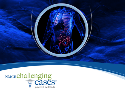 A digital illustration of a human body with a blue background. The body is shown in a circular frame with a white border. Inside the frame there is a detailed view of the internal organs and structures of the human body. The organs are shown in red and blue colors with the central organs being the largest and the smaller ones being the smallest. The background is a deep blue color with wavy lines giving the image a sense of depth and movement. The image is accompanied by the text "NMCR Challenging Cases" and the logo of the company powered by Xcenda.