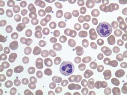 The image appears to be a microscopic view of a group of small round light brown cells. The cells are arranged in a scattered pattern with some overlapping each other. In the center of the image there are two small purple-colored cells which appear to be blood cells. These cells are likely blood vessels as they are round and have a smooth surface. The background is white which makes the cells stand out.