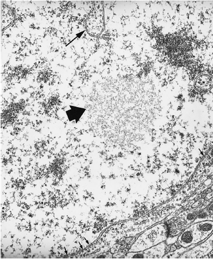 A black and white microscopic view of a group of small irregularly shaped cells. The cells appear to be densely packed together with some overlapping and some standing upright. There are two black arrows pointing towards the center of the image one on the left side and one in the right side. The background is white and the cells are outlined in black. The image appears to be a cross-section of a tissue sample as there are no other structures or structures visible.