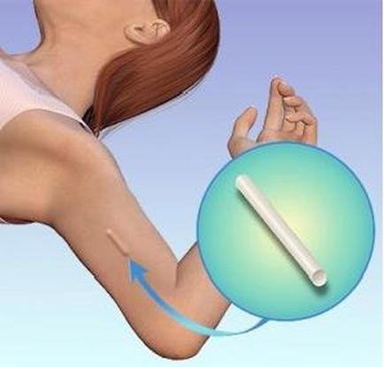 A young woman with red hair wearing a pink tank top holding a blue sphere with a white stick attached to it. The stick appears to be a thermometer which is used to measure the temperature of the woman's arm. The background is a light blue color and there is an arrow pointing to the right side of the image indicating that the thermometer is being used to adjust the temperature.