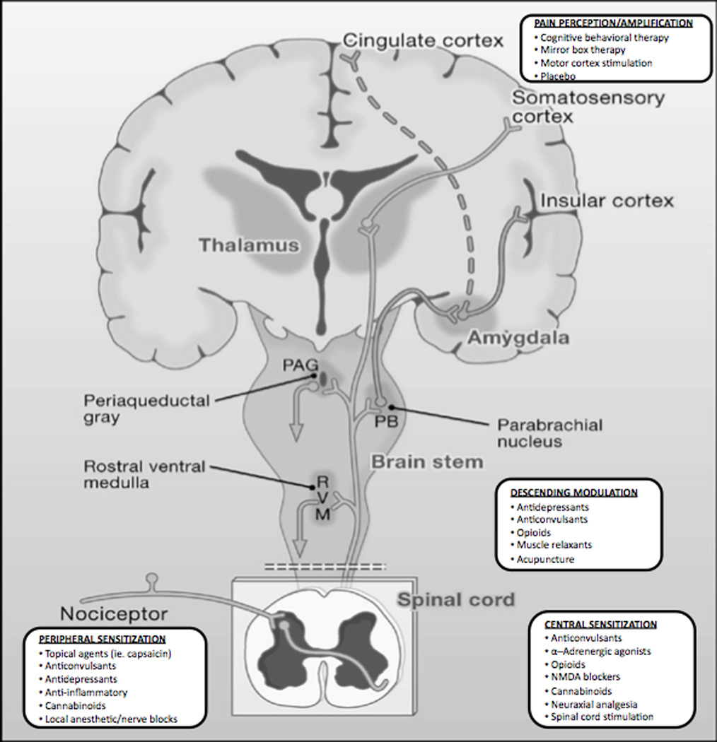 A diagram of the brain shown in cross-section. Labelled parts include the cingulate cortex the somatosensory cortex the insular cortex the thalamus the amygdala the periaqueductal gray the parabrachial nucleus the brain stem the rostral ventral medulla the spinal cord the nociceptor etc. There are also text boxes for Pain Perception / Amplification Descending Modulation Peripheral Sensitization and Central Sensitization. The background is gray with graphic elements in gray and white with text in gray and black.
