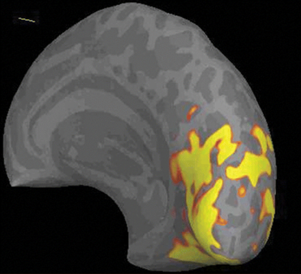 A 3D model of a human ear. The ear appears to be elongated and curved with a pointed tip on the left side. The surface of the ear is covered in a grayish-grey color with some areas appearing darker and more prominent. On the right side of the image there is a yellow and orange pattern that resembles a fire or explosion. The pattern is made up of small irregularly shaped lines and shapes creating a textured appearance. The background is black making the ear stand out.