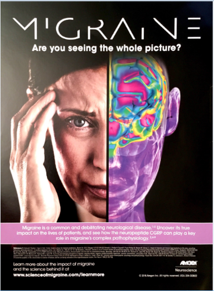 An advertisement for Migraine a common and debilitating neurological disease. The background is black and the text is white. On the left side of the image there is a close-up of a woman's face with her hand on her forehead indicating that she is experiencing migraine. The text on the image reads "Migraine: Are you seeing the whole picture?" and on the right side there are two images side by side. The first image on the left shows the woman's head with her eyes closed and her head tilted to the side as if she is deep in thought. The brain is colored in different shades of pink blue and green representing the different areas of the brain. The colors are arranged in a way that creates a sense of depth and dimension. The image also includes text that reads "Learn more about the impact of migraine and the science behind it at www.scienceofmigraine.com/beardmore." At the bottom of the advertisement it states that Migraine is a common disease that affects the brain and helps to improve its true impact on the lives of patients and how it can play a key role in migraine complex pathophysiology.
