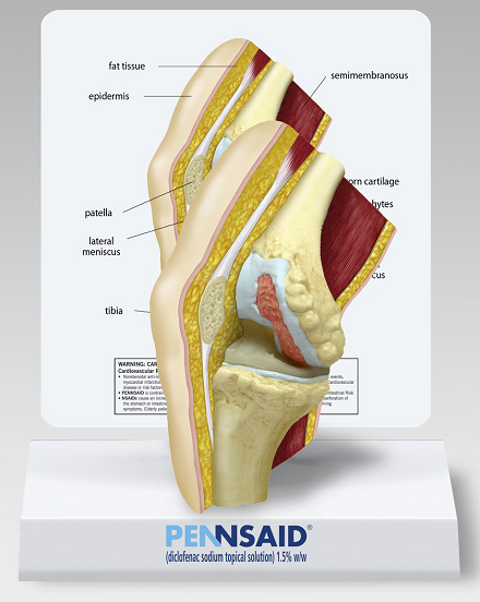 A photograph of a medical model showing a knee. It is a cross-section showing parts of the knee including the epidermis fat tissue patella lateral meniscus tibia semimembranosus and others. The model is sitting on a stand which appears to be made of white cardboard. The base of the stand has the Pennsaid logo.