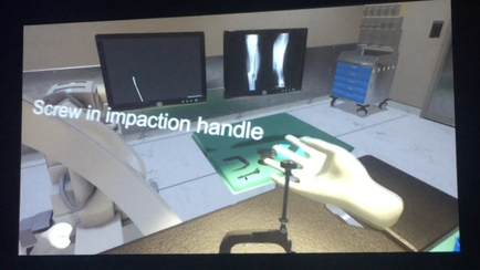 A 3D rendering of a medical examination room with two monitors on the wall. On the left side of the image there is a chair with a white armrest and a green mat on the floor. In front of the chair there are two X-ray images of a person's hand holding a screw in an impact handle. The text on the image reads "Screw in impact handle".