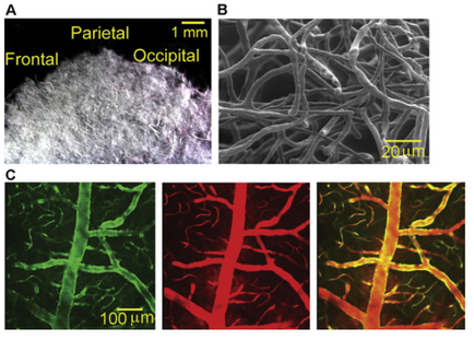 A collage of four different images. The first image on the top left shows a close-up of a parietal which is a type of nerve cell. The parietal is 1 mm in diameter and is located in the center of the image. It appears to be a microscopic view of the outermost part of the brain. In the top right image there is a black and white image of a group of neurons. The neurons are arranged in a radial pattern with some overlapping each other. The image is labeled with the letters "A" "B" "C" "D" "E" "F" "G" "H" "J" "K" "L" "M" and "E". Below the images there are four smaller images in the bottom left corner each showing a different color - green red and orange. The green image shows a tree-like structure while the red and orange images show a tree with red and yellow branches. The trees appear to be neurons and the image is taken from a top-down perspective.